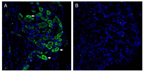 AGR-051 Anti-GPR35 (extracellular) Antibody