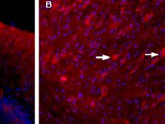 AK-595 Neuroligin & Neurexin Antibody Explorer Kit