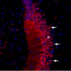 ACC-105-AR Anti-CACNB2-ATTO Fluor-594 Antibody