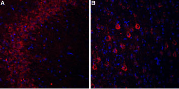 ACC-103 Anti-CACNA2D3 (CaVα2δ3) (extracellular) Antibody