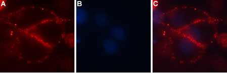 ACC-104 Anti-CACNA2D4 (CaVα2δ4) (extracellular) Antibody