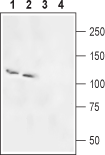 ANT-076 Anti-Rat SLC4A5 (NBC4) Antibody