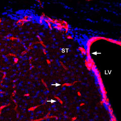 AGT-021 Anti-GLUT1 Antibody