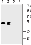 AGP-045 Guinea pig Anti-KCNN2 (KCa2.2, SK2) Antibody