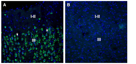 ANR-132 Anti-SORL1 (extracellular) Antibody