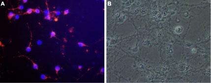 ANT-008 Anti-Nogo Receptor (extracellular) Antibody